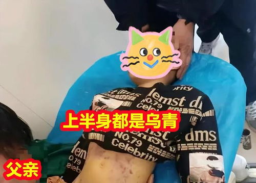 男童遭生母与男友虐待致死，姥姥期盼严判以伸正义