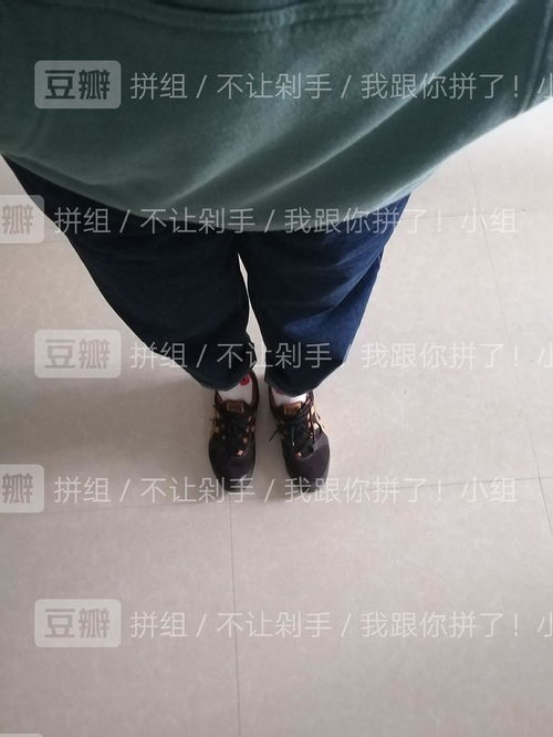 女子遭遇花百元买的裤子掉色事件，双腿被染紫的困扰