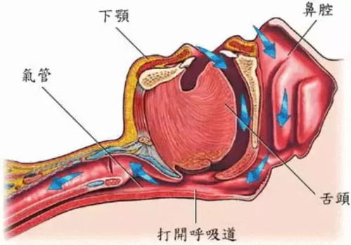 苟伟死因曝光 鼻息肉肥大致呼吸骤停